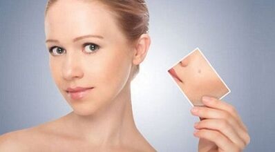 Überprüfung wirksamer Heilmittel gegen Warzen und Papillome