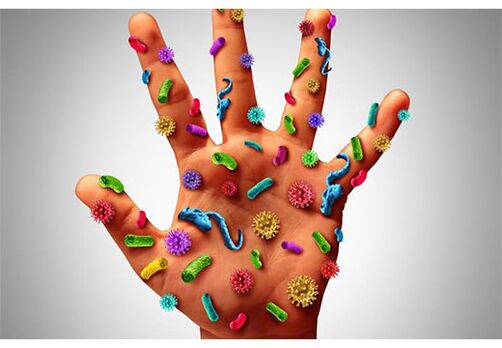 Die Herde des humanen Papillomavirus finden sich an den Händen. 